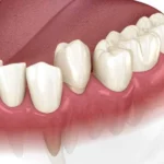 How Family Dentists Monitor Growth And Development From Baby Teeth To Teen Years