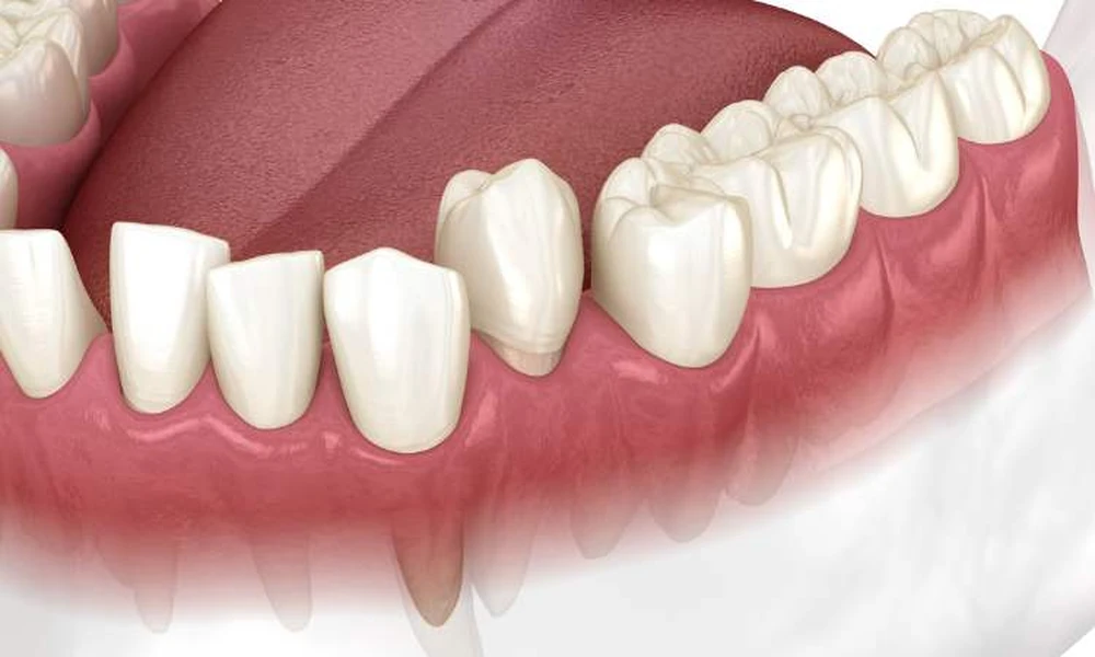 How General Dentistry Detects Bite Alignment Issues Early